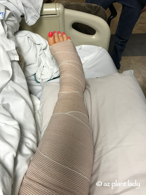 mother fell and broke her leg 